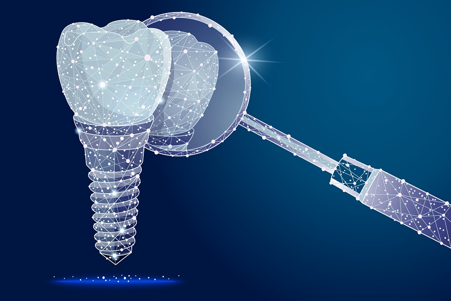 UNDERSTANDING DENTAL IMPLANTS