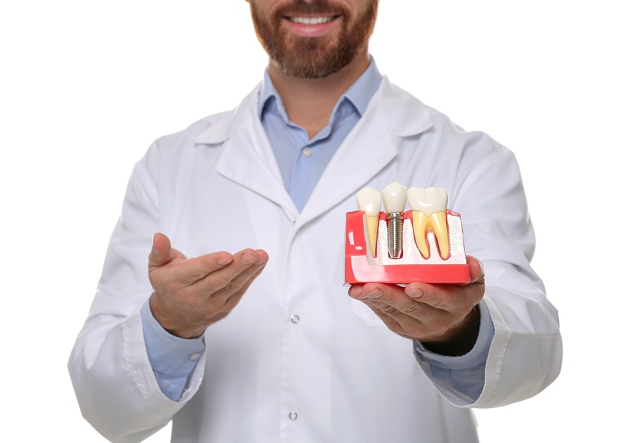 Why Dental Implants are the Best Solution for Missing Teeth