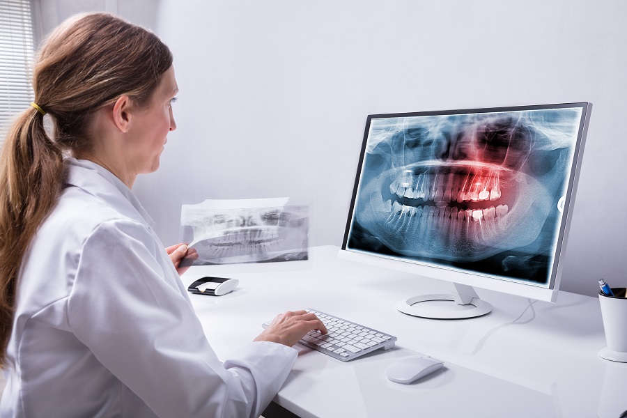 UNDERSTANDING THE CAUSES AND DANGERS OF GINGIVITIS