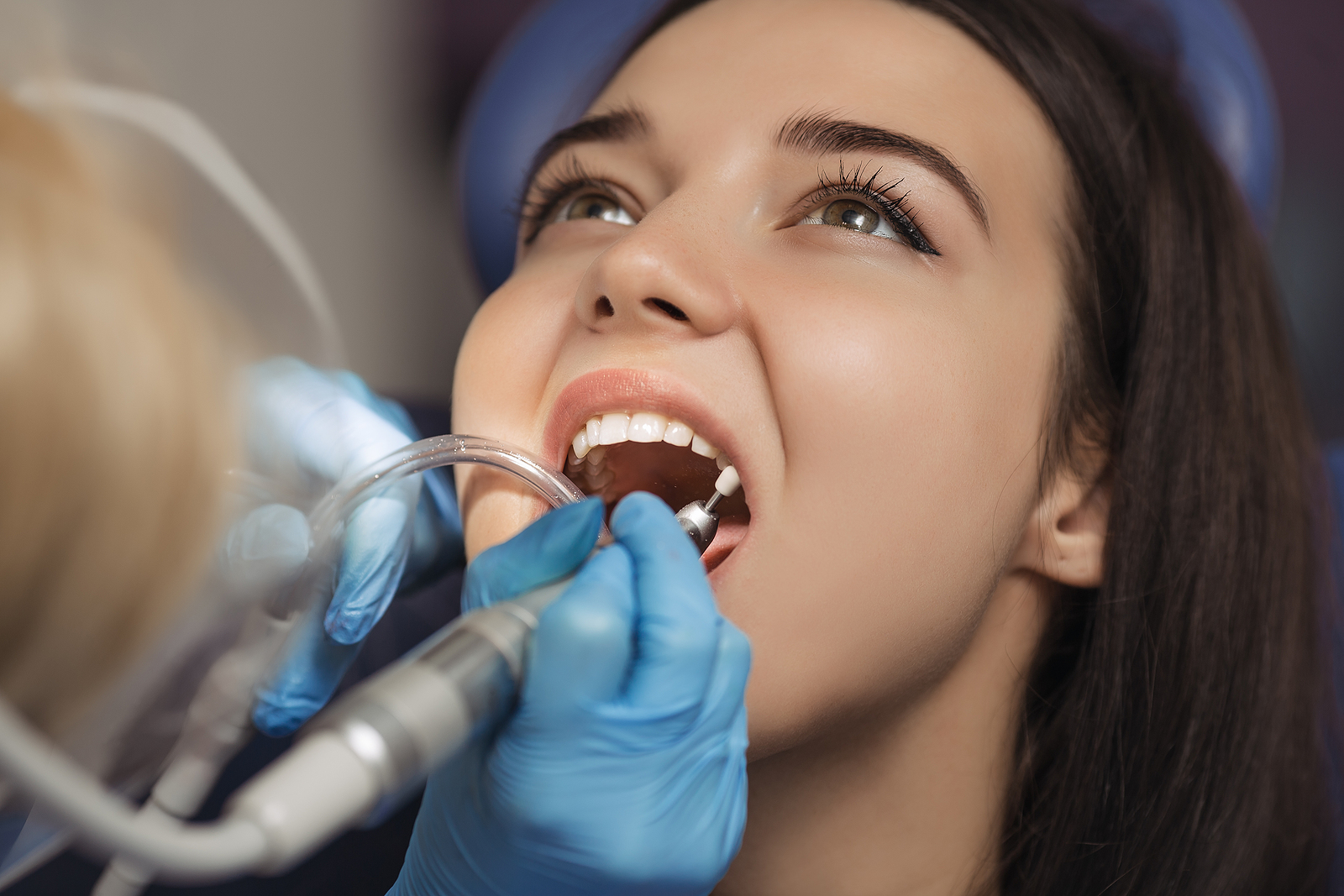 What is Gingival Grafting? A Comprehensive Guide to the Procedure